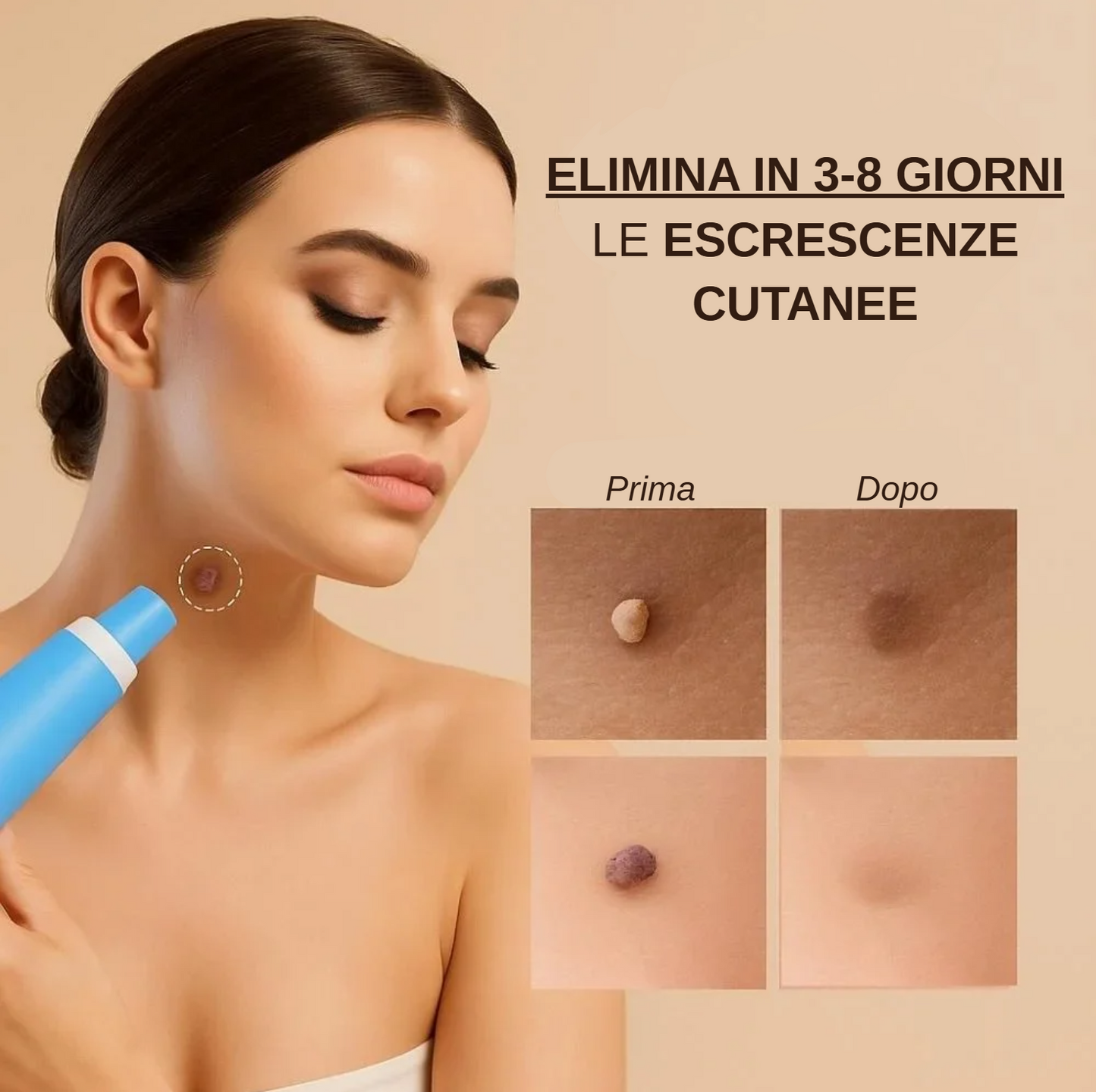 Leviora™ - Kit completo rimozione escrescenze cutanee